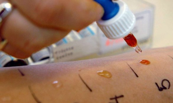 Allergologia
